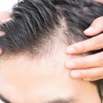 Как оценить качество клиники пересадки волос? 7 важных факторов
